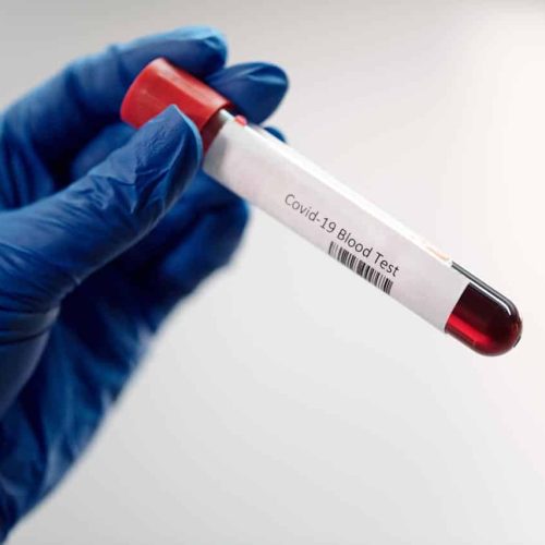 coursier produits sanguins Nice